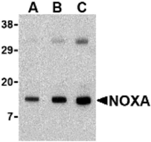 NOXA antibody