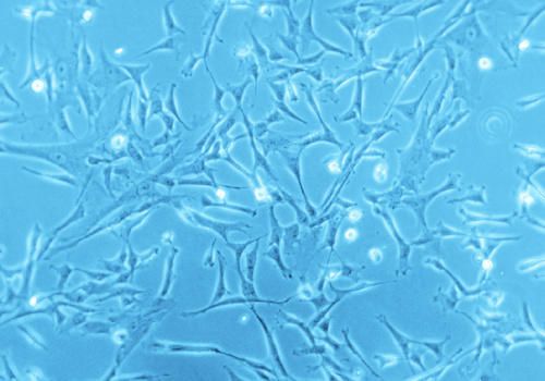 Human Mesenchymal Stem Cells from Umbilical Cord Matrix (hMSC-UC), PromoCell