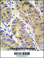 Anti-MMP13 Rabbit Polyclonal Antibody
