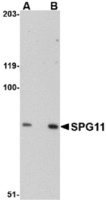 Anti-SPG11 Rabbit Polyclonal Antibody