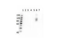 Anti-HbBs Mouse Monoclonal Antibody [Clone: 23E5.H6.G6.C1.H7.F7.G9.F6]
