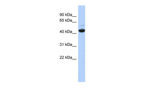 Anti-ATP6V1C1 Rabbit Polyclonal Antibody