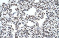 Anti-TMPRSS11D Rabbit Polyclonal Antibody
