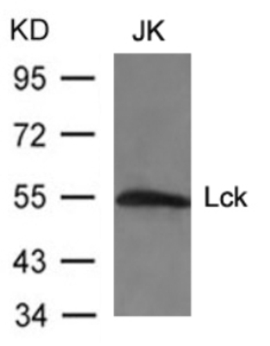 Lck (Ab 394) Antibody
