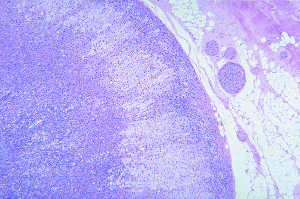 Adrenal Gland, Mammal Slide 