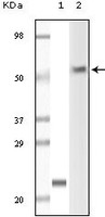 Anti-LCK Mouse Monoclonal Antibody [clone: 8E5F9 / 4B2C7]