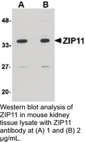 Anti-ZIP11 Rabbit Polyclonal Antibody