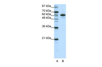 Anti-CBLL1 Rabbit Polyclonal Antibody