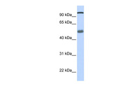 Anti-DHX32 Rabbit Polyclonal Antibody