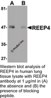 Anti-REEP4 Rabbit Polyclonal Antibody