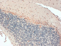 Anti-KCNAB1 Mouse Monoclonal Antibody [clone: S9-40]