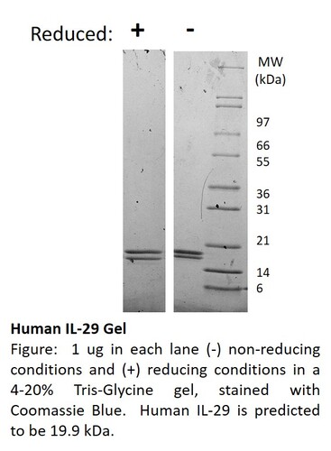Human Recombinant IL-29 (from <i>E. coli</i>)