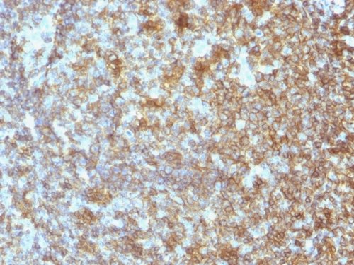 ANTIBODY ANTI-CD45 SPM496 100UG