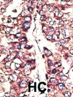 Anti-MAGEA11 Rabbit Polyclonal Antibody