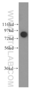 Anti-DDX1 Rabbit Polyclonal Antibody