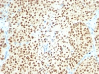 Anti-SOX10 Mouse Monoclonal Antibody [clone: SPM607]
