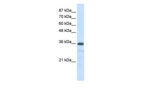U1SNRNPBP Antibody