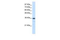 Anti-SNRNP35 Rabbit Polyclonal Antibody