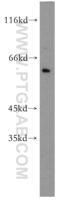 Anti-NOP56 Rabbit Polyclonal Antibody