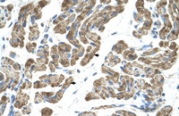 Anti-ACVR1 Rabbit Polyclonal Antibody