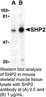 Anti-PTPN11 Rabbit Polyclonal Antibody
