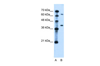 Anti-LRRC26 Rabbit Polyclonal Antibody