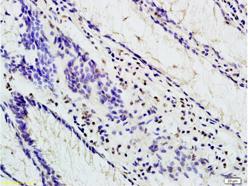 TBL1 Antibody