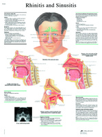 3B Scientific® Rhinitis Chart