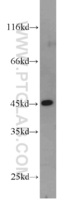 Anti-FBLIM1 Rabbit Polyclonal Antibody