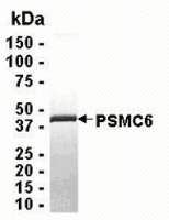 Human Recombinant Psmc6 (from E. coli)