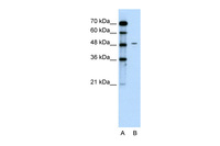 Anti-CHGA Rabbit Polyclonal Antibody