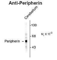 Anti-PRPH Chicken Polyclonal Antibody