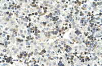 Anti-HSD17B6 Rabbit Polyclonal Antibody