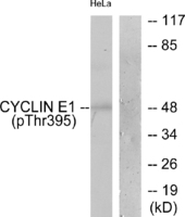 Anti-Cyclin E1 Rabbit Polyclonal Antibody