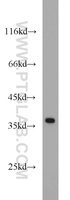 Anti-APEX1 Rabbit Polyclonal Antibody