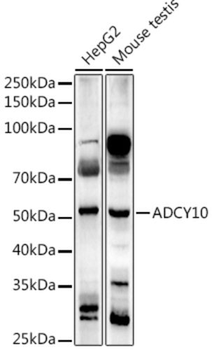 Anti-ADCY10/SAC Rabbit Polyclonal Antibody