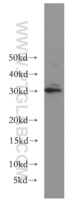 Anti-BIN3 Rabbit Polyclonal Antibody