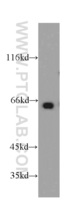 Anti-MEF2C Rabbit Polyclonal Antibody
