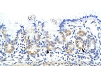 Anti-ZNF322 Rabbit Polyclonal Antibody