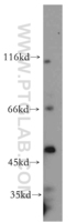 Anti-NFYC Rabbit Polyclonal Antibody