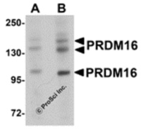 Anti-PRDM16 Rabbit Polyclonal Antibody
