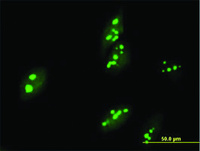 Anti-ABT1 Mouse Polyclonal Antibody