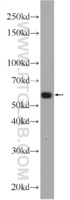 Anti-TMEM161A Rabbit Polyclonal Antibody