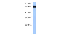 Anti-HNRNPM Rabbit Polyclonal Antibody