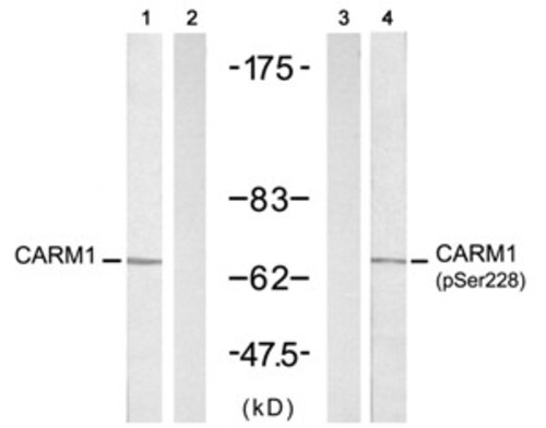 CARM1 (Ab 228) Antibody