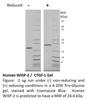 Human Recombinant WISP-2 (from E. coli)