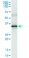 Anti-ABCC10 Polyclonal Antibody Pair