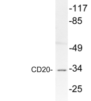 Anti-CD20 Rabbit Polyclonal Antibody