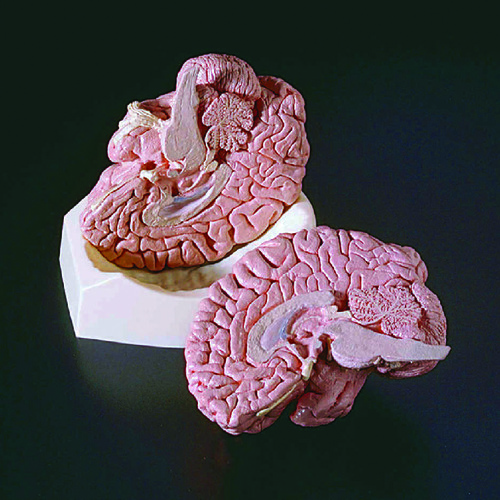 MODEL WARDS BRAIN