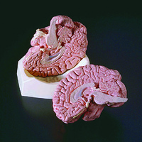 Ward's® Brain Model